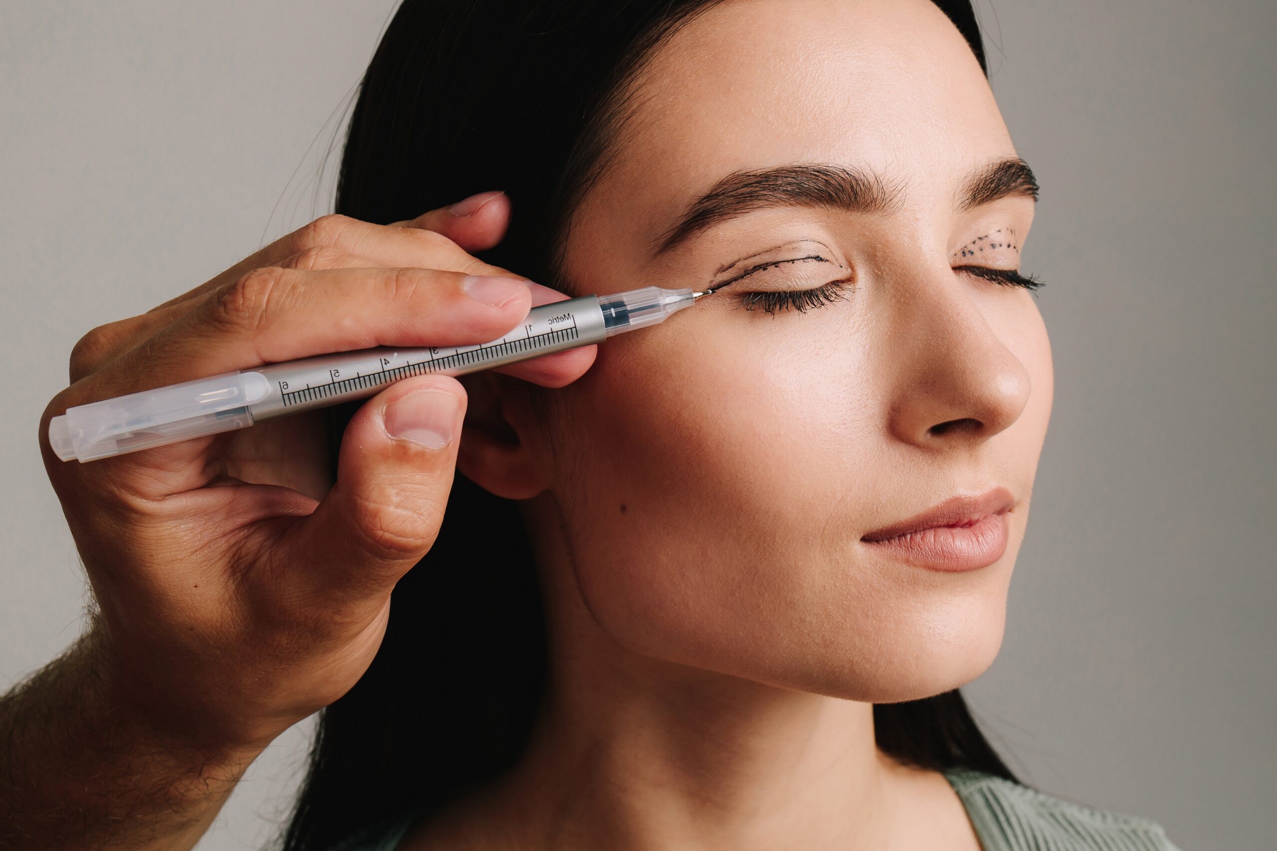 Blepharoplasty in North Vancouver, BC
